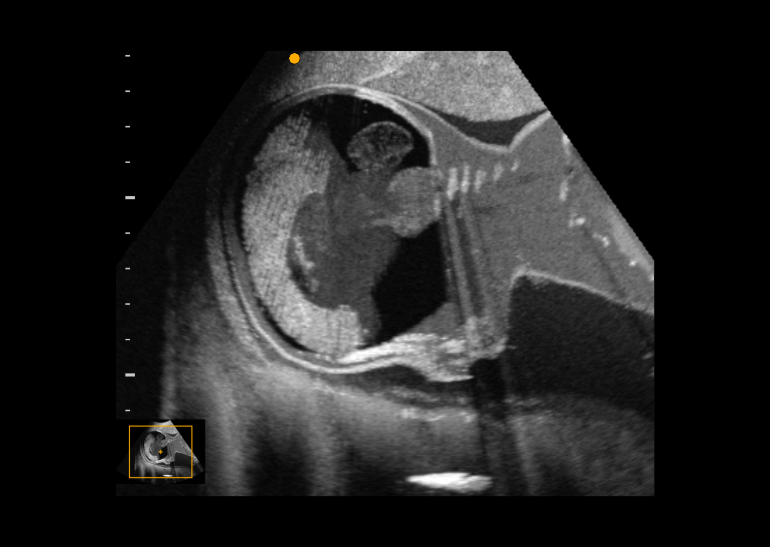 Ultrasound image